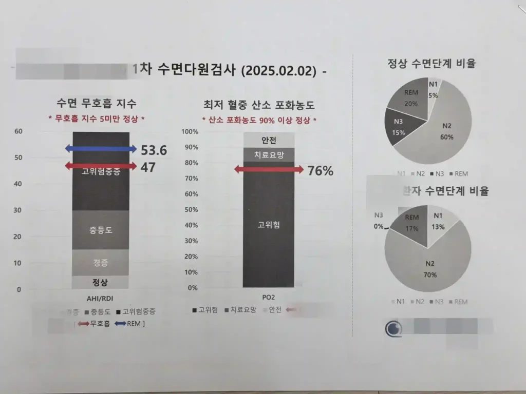 수면다원검사 측정치