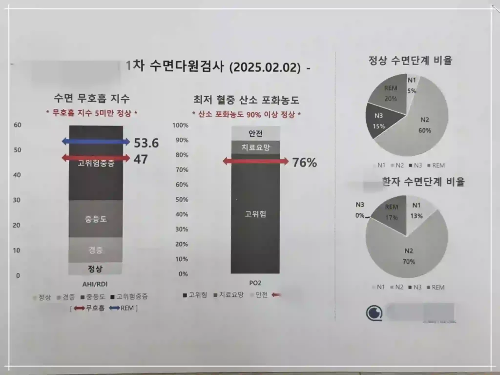 수면다원검사 결과
