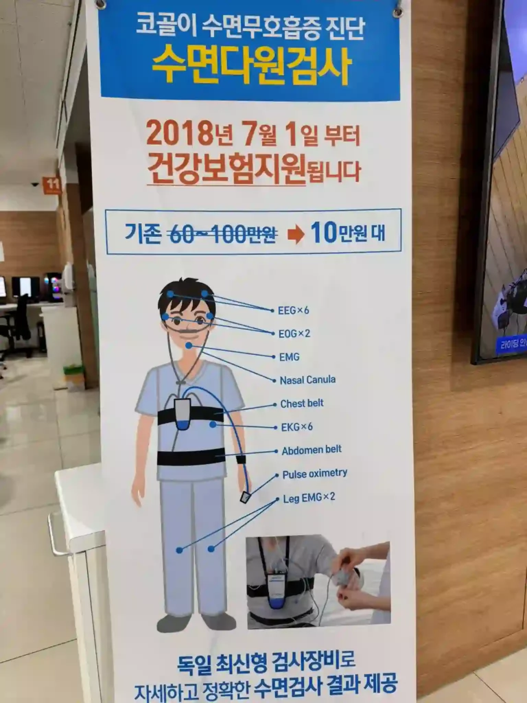 수면다원검사 건강보험 지원