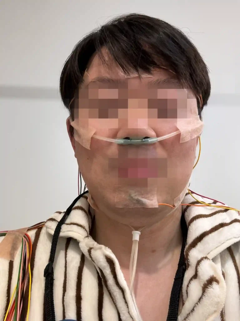 수면무호흡 증상으로 수면다원검사 진행중