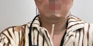 수면무호흡증 치료