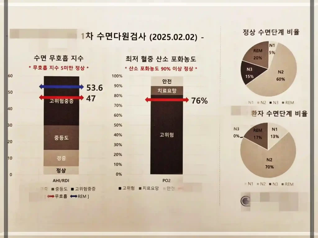 1차 수면다원검사 결과