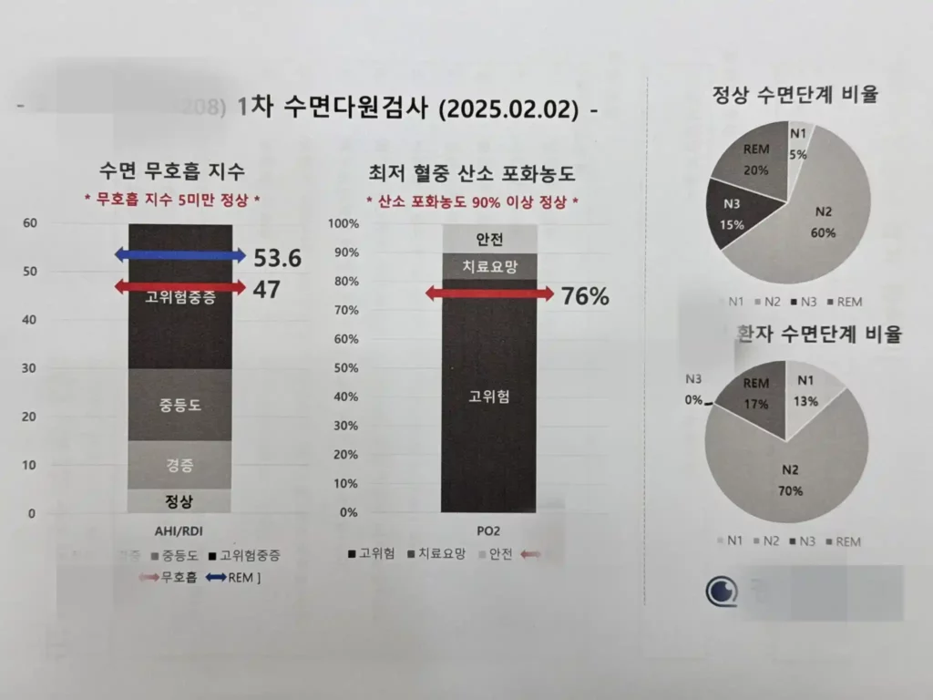 수면다원검사 결과